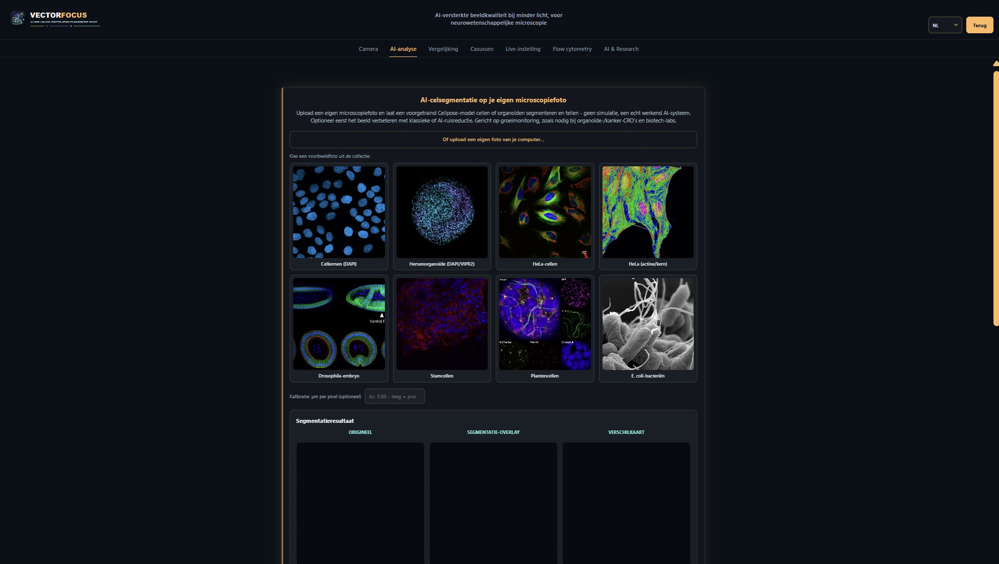 AI-celsegmentatie - voorbeeldfoto's uit celkernen tot E. coli-bacteriën